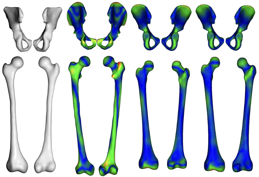 Technology to Advance Treatment of Children With Movement Disorders